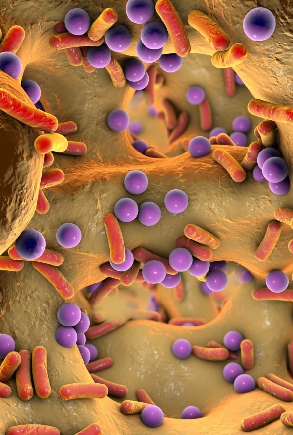 Probiotics for IVF Success